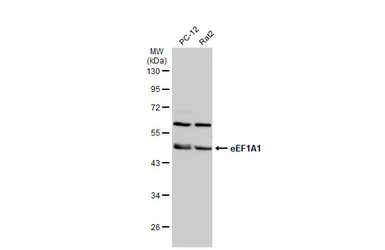 Anti-eEF1A1 antibody [N1C1] used in Western Blot (WB). GTX102285