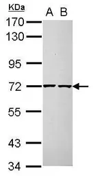 Anti-CDC25A antibody used in Western Blot (WB). GTX102308