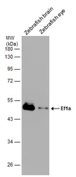 Anti-EEF1A2 antibody used in Western Blot (WB). GTX102326
