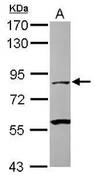 Anti-Calpain 1 antibody used in Western Blot (WB). GTX102350