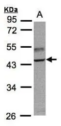 Anti-TRAF1 antibody [N1C1] used in Western Blot (WB). GTX102372
