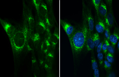 Anti-Albumin antibody used in Immunocytochemistry/ Immunofluorescence (ICC/IF). GTX102419