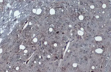 Anti-Tyrosine Hydroxylase antibody [N1C1] used in IHC (Paraffin sections) (IHC-P). GTX102424