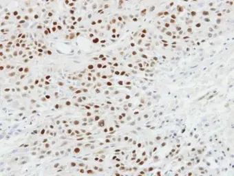 Anti-p63 antibody [N2C1], Internal used in IHC (Paraffin sections) (IHC-P). GTX102425