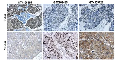 Anti-p63 antibody [N2C1], Internal used in IHC (Paraffin sections) (IHC-P). GTX102425