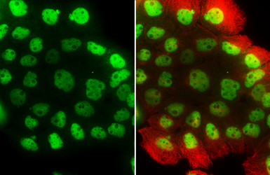 Anti-p63 antibody [N2C1], Internal used in Immunocytochemistry/ Immunofluorescence (ICC/IF). GTX102425