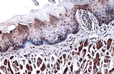 Anti-p63 antibody [N2C1], Internal used in IHC (Paraffin sections) (IHC-P). GTX102425