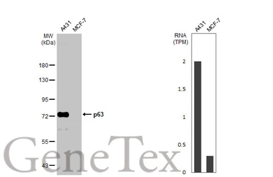 Anti-p63 antibody [N2C1], Internal used in Western Blot (WB). GTX102425