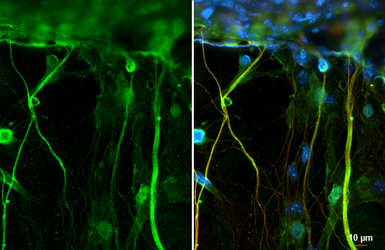 Anti-Cav2.2 antibody [C3], C-term used in Immunocytochemistry/ Immunofluorescence (ICC/IF). GTX102449