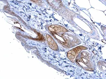 Anti-Desmoglein 2 antibody [N1N2], N-term used in IHC (Paraffin sections) (IHC-P). GTX102508