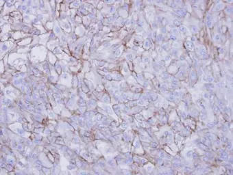 Anti-Desmoglein 2 antibody [N1N2], N-term used in IHC (Paraffin sections) (IHC-P). GTX102508