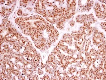 Anti-RPB2 antibody [N1], N-term used in IHC (Paraffin sections) (IHC-P). GTX102535