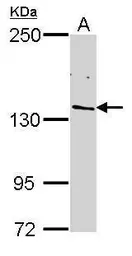 Anti-RPB2 antibody [N1], N-term used in Western Blot (WB). GTX102535