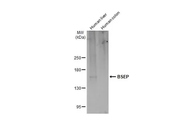 Anti-BSEP antibody [N3C1], Internal used in Western Blot (WB). GTX102608