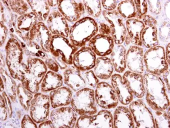 Anti-ACAT1 antibody [N1N3] used in IHC (Paraffin sections) (IHC-P). GTX102637