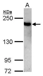 Anti-Topoisomerase II beta antibody [C3], C-term used in Western Blot (WB). GTX102640