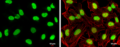 Anti-Topoisomerase II beta antibody [C3], C-term used in Immunocytochemistry/ Immunofluorescence (ICC/IF). GTX102640