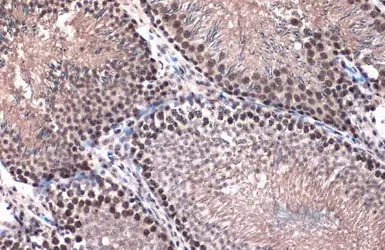 Anti-Topoisomerase II beta antibody [C3], C-term used in IHC (Paraffin sections) (IHC-P). GTX102640