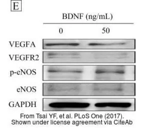 Anti-VEGFA antibody used in Western Blot (WB). GTX102643