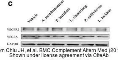 Anti-VEGFA antibody used in Western Blot (WB). GTX102643