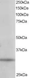 Anti-PITPN / PITP alpha antibody, C-term used in Western Blot (WB). GTX10265