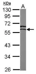 Anti-ERR gamma antibody used in Western Blot (WB). GTX102664