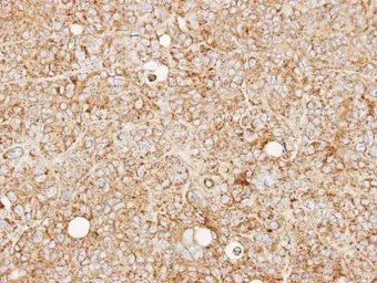 Anti-MCCC2 antibody [N1C1] used in IHC (Paraffin sections) (IHC-P). GTX102674