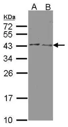 Anti-HSD3B2 antibody used in Western Blot (WB). GTX102744
