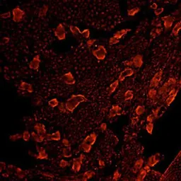Anti-Mu Opioid receptor antibody used in Immunohistochemistry (IHC). GTX10275