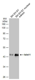 Anti-Islet 1 antibody used in Western Blot (WB). GTX102807
