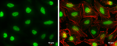 Anti-AF9 antibody used in Immunocytochemistry/ Immunofluorescence (ICC/IF). GTX102835