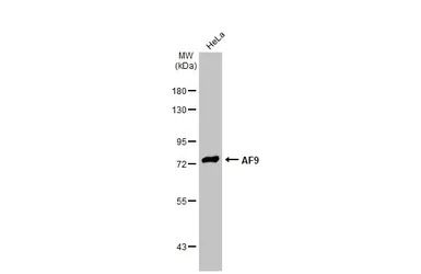 Anti-AF9 antibody used in Western Blot (WB). GTX102835