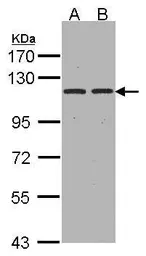 Anti-Aminopeptidase A antibody [C2C3], C-term used in Western Blot (WB). GTX102838