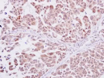 Anti-DNA polymerase delta antibody used in IHC (Paraffin sections) (IHC-P). GTX102888