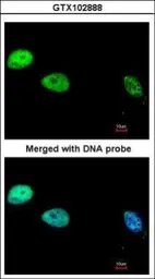 Anti-DNA polymerase delta antibody used in Immunocytochemistry/ Immunofluorescence (ICC/IF). GTX102888