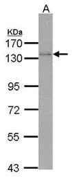 Anti-DNA polymerase delta antibody used in Western Blot (WB). GTX102888