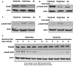 Anti-TLK1 antibody [N2C2], Internal used in Western Blot (WB). GTX102891
