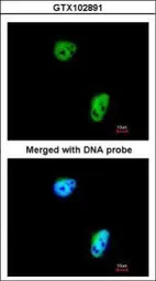 Anti-TLK1 antibody [N2C2], Internal used in Immunocytochemistry/ Immunofluorescence (ICC/IF). GTX102891