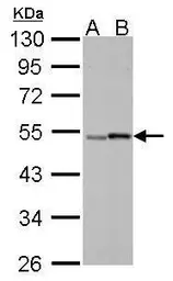 Anti-Retinoic Acid Receptor gamma antibody used in Western Blot (WB). GTX102914