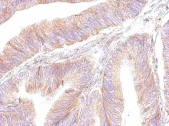 Anti-ATP synthase B1 antibody used in IHC (Paraffin sections) (IHC-P). GTX102980