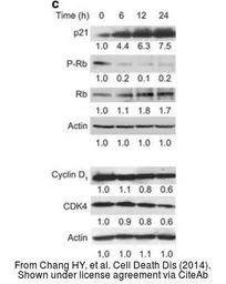 Anti-CDK4 antibody used in Western Blot (WB). GTX102993