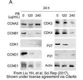 Anti-CDK4 antibody used in Western Blot (WB). GTX102993