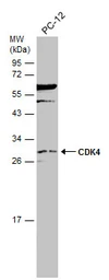 Anti-CDK4 antibody used in Western Blot (WB). GTX102993
