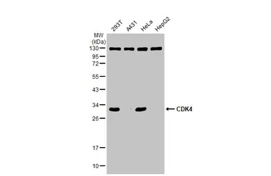 Anti-CDK4 antibody used in Western Blot (WB). GTX102993