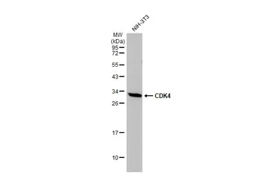 Anti-CDK4 antibody used in Western Blot (WB). GTX102993