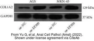 Anti-COL1A2 antibody [C2C3], C-term used in Western Blot (WB). GTX102996