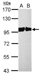 Anti-CSE1L antibody used in Western Blot (WB). GTX103005