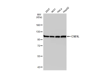 Anti-CSE1L antibody used in Western Blot (WB). GTX103005