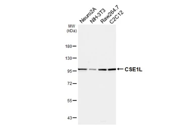 Anti-CSE1L antibody used in Western Blot (WB). GTX103005