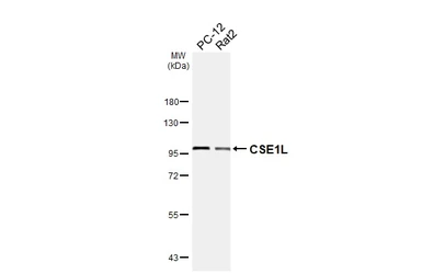 Anti-CSE1L antibody used in Western Blot (WB). GTX103005